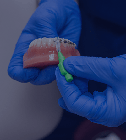 Treatment - Chase Side Dental