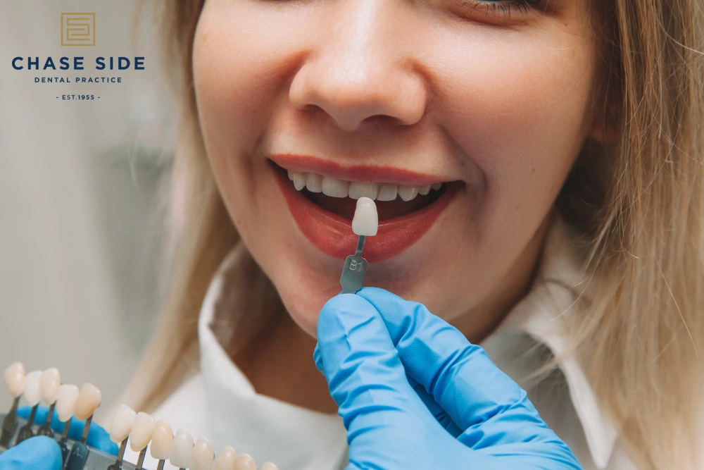 Is Professional Teeth Whitening Better Than Shop-Bought Kits?