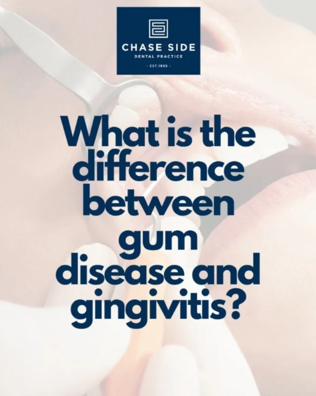 Gingivitis is a superficial inflammation of the gum due to poor oral hygiene. 
Gum disease is when long standing gingivitis has caused more deep rooted inflammation that causes loss of bone that anchors the teeth.
If gum disease is left untreated, it will lead to premature loss of teeth.
Keep your smile healthy with regular check ups and cleanings! 😁

📞 020 8363 6363
📨 contact@chasesidedental.co.uk
🌍 www.chasesidedental.co.uk