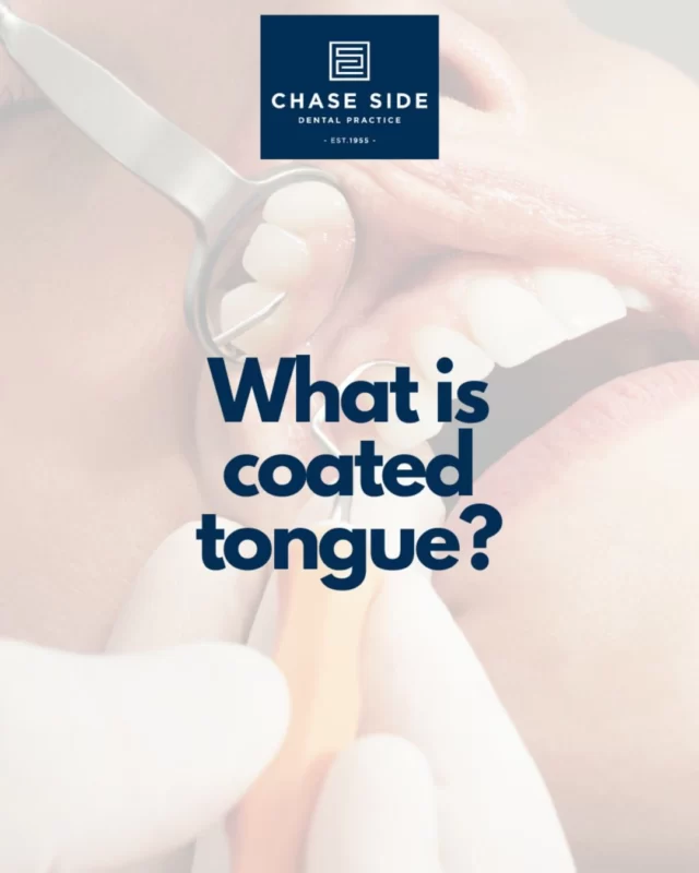 A coated tongue happens when a layer of debris, bacteria, and dead cells builds up on the surface of the tongue — often appearing white, but sometimes yellow or brown.

How to manage it:
✅ Quit smoking – it's great for your health and your tongue
🥕 Eat rough, fibrous foods like raw fruits & veggies
💧 Stay hydrated – drink plenty of water
🪥 Gently clean your tongue with a scraper or separate toothbrush
🍬 Chew sugar-free gum to boost saliva flow

Keep your mouth fresh and healthy with a complete oral hygiene routine! 🦷✨

📞 020 8363 6363
📨 contact@chasesidedental.co.uk
🌍 www.chasesidedental.co.uk