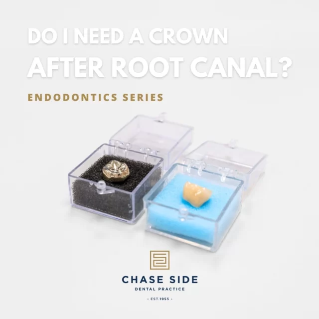 A crown is a cap that covers a tooth and is typically placed to restore the tooth’s function and reduce its chance of fracturing following a root canal treatment.

Crowns are typically made from materials such as porcelain and gold and are designed to mimic the look and feel of a natural tooth. By encapsulating the damaged or weakened tooth, crowns improve the tooth's strength and durability making them an essential component in restorative dentistry.

Regular dental check-ups can ensure your crown remains in good condition and continues to protect your smile effectively! 🦷👑

#DentalHealth #RestorativeDentistry #OralCare #HealthySmile #dentalcrown #rootcanal #endodontics #chasesidedentalpractice #chaseside #enfield #dentistenfield #dental #dentist #dentalhealth #dentistlondon #northlondondentist #implants #teethwhiteninglondon #endodontics #compositebonding #generaldentistrylondon #hygienelondon #hygienist