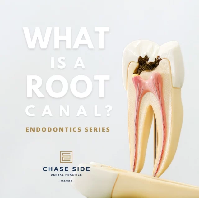 A root canal is a dental treatment performed to save an infected or deeply decayed tooth. Endodontic treatment is recommended as an option instead of tooth extraction.

The procedure involves removing the infected nerve and damaged tissue from inside the tooth. The tooth is then cleaned and disinfected before it is filled with a rubber-like material known as gutta percha. Following the treatment, a crown must be placed over the tooth to reduce its risk of fracturing and restore its function.

If you are experiencing tooth discomfort don't hesitate to reach out to your dentist for advice. Arrange your next appointment today!🦷😁📞

#rootcanal #endodontic #saveyourtooth #restorativedentistry #DentalEducation #RootCanalAwareness #OralHealthMatters #chasesidedentalpractice #chaseside #enfield #dentistenfield #dental #dentist #dentalhealth #dentistlondon #northlondondentist #implants #teethwhiteninglondon #endodontics #compositebonding #generaldentistrylondon #hygienelondon #hygienist
54 w