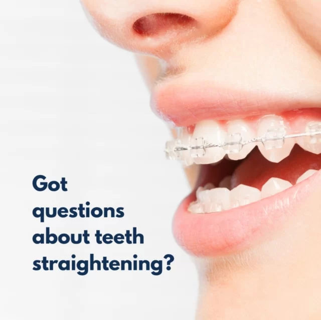 If our dentists notice that your little one may benefit from orthodontic care, we’ll provide a referral to a trusted orthodontist for further assessment.
If you have any concerns about your child’s teeth alignment, bite or the orthodontic process, our dentists are happy to discuss this with you during a check-up. We’re here to answer your questions and guide you every step of the way! 🦷💙
Call us today on 020 8363 6363 to book an appointment! 📞
#HealthySmiles #OrthodonticReferral #FamilyDentistry #chasesidedentalpractice #chaseside #enfield #dentistenfield #dental #dentist #dentalhealth #dentistlondon #northlondondentist #implants #teethwhiteninglondon #endodontics #compositebonding #generaldentistrylondon #hygienelondon #hygienist