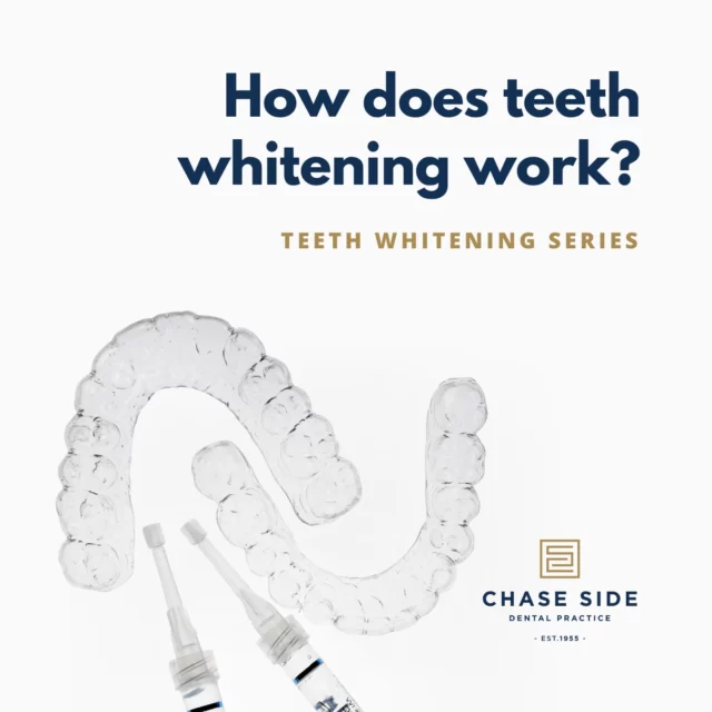 · How it works: The active ingredient (carbamide peroxide) is broken down, allowing oxygen to enter the enamel and dentine, resulting in the lightening of the tooth colour itself.

· Process: The treatment usually takes between 2 to 6 weeks, depending on the extent of discoloration. For severe tetracycline stains, it might take 6 to 12 months for noticeable results.

· Sensitivity: It is normal for some individuals may experience sensitivity during the whitening process. Consult your dentist for tips on minimising discomfort.

· Maintenance: Whitened teeth generally stay bright for 1 to 3 years. However, touch-ups every 6 to 12 months might be needed, especially if you consume coffee, red wine or cola, which can speed up discoloration.

· Safety: Research shows that dentist-prescribed home whitening is safe for your teeth, gums and other tissues of the mouth. The whitening agents used have a neutral pH.

For the best results and personalised advice, always follow your dentist’s recommendations.

#TeethWhitening #OralHealth #BrightSmile #chasesidedentalpractice #chaseside #enfield #dentistenfield #dental #dentist #dentalhealth #dentistlondon #northlondondentist #implants #teethwhiteninglondon #endodontics #compositebonding #generaldentistrylondon #hygienelondon #hygienist