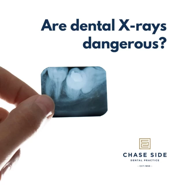 Dental X-rays are crucial for identifying problems that are not visible to the naked eye, such as cavities between teeth or existing fillings, unerupted or impacted teeth, infections or even bone loss. Today's dental X-ray technology uses minimal radiation, making it both safe and effective for routine diagnostic purposes.

A routine dental X-ray exposes you to about 0.005 millisieverts (mSv) of radiation. To put that in perspective, you're exposed to 10 times that amount (0.05 mSv) just from a few hours in the sun 🌞 and a cross-country flight gives you around 0.04 mSv ✈️.

The radiation from dental X-rays is minimal and essential for detecting hidden dental issues. Your dentist only recommends them when absolutely necessary! 😁
📞 020 8363 6363
📨 contact@chasesidedental.co.uk
🌍 www.chasesidedental.co.uk

#DentalHealth #XRaySafety #HealthyTeeth #chasesidedentalpractice #chaseside #enfield #dentistenfield
