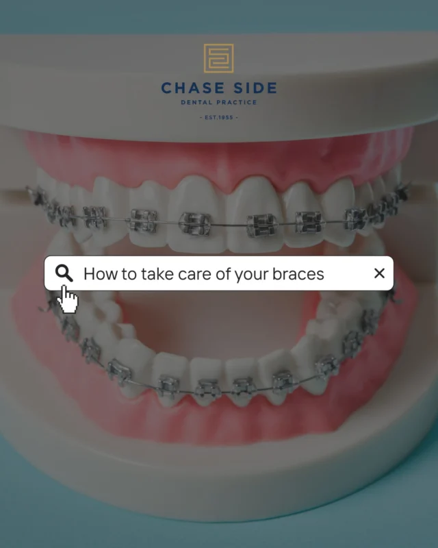 Braces are working hard to give you your future smile — but your daily habits matter too!

✨ Brush properly — take your time around your brackets and along the gumline.
 💙Clean between your teeth — interdental brushes can be a game-changer!
🍬 Watch the sugar — frequent sugary snacks and drinks can increase your risk of tooth decay.
🥕 Be careful with hard foods — protect those brackets and avoid unnecessary breakages.
📅 Don’t miss your appointments — regular check-ups are an important part of keeping your treatment on track.
😁 And keep smiling! — braces are temporary, but looking after your teeth is forever.

Your future smile starts with what you do today. 

Save this post as your braces care reminder! 📌

#Braces #BracesCare #TeenBraces #Orthodontics #TeenDentalHealth #HealthySmile #BracesTips #OralHealth #SmileJourney  #Enfield #EnfieldDentist #EnfieldCommunity #ChaseSideDental